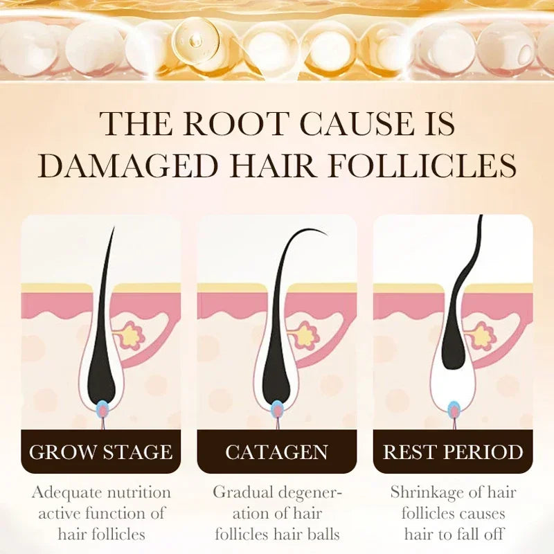 Biotin Fast Hair Growth Oil Products Care Scalp Massage Treatments Anti Hair Loss Effective Grow Thicker Hair Serum for Men