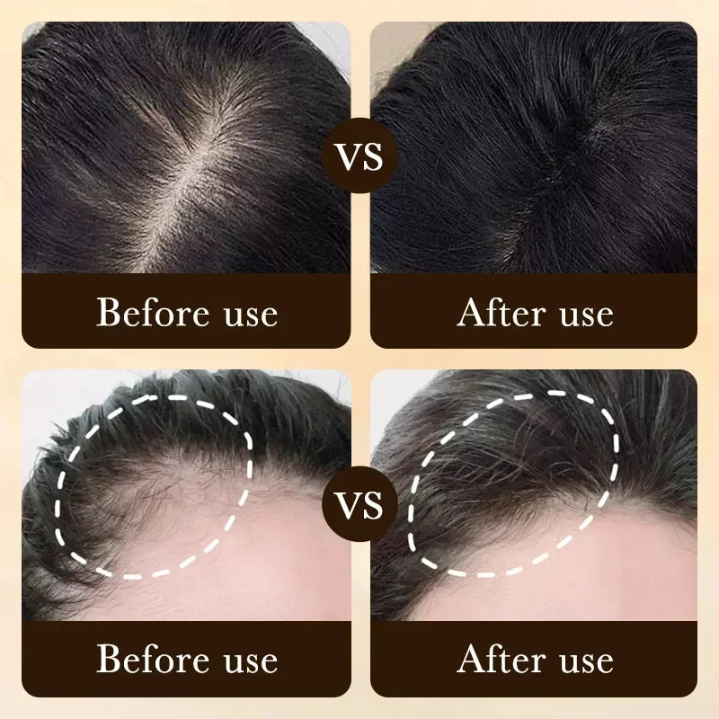 Biotin Fast Hair Growth Oil Products Care Scalp Massage Treatments Anti Hair Loss Effective Grow Thicker Hair Serum for Men