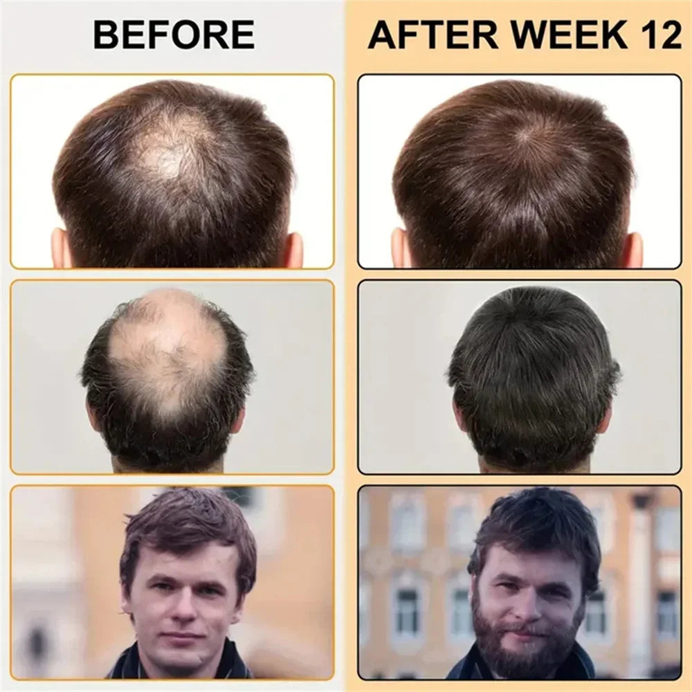 Biotin Fast Hair Growth Oil Products Care Scalp Massage Treatments Anti Hair Loss Effective Grow Thicker Hair Serum for Men