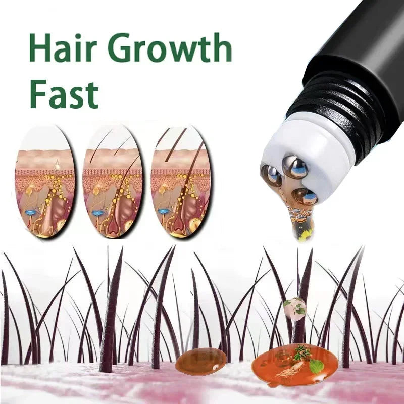Biotin Fast Hair Growth Oil Products Care Scalp Massage Treatments Anti Hair Loss Effective Grow Thicker Hair Serum for Men